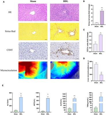 Protective role of the CD73-A2AR axis in cirrhotic cardiomyopathy through negative feedback regulation of the NF-κB pathway